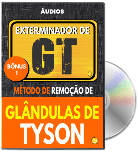 etxerminado de gt audio 277x300 1 - Exterminador De GT - Método De Remoção De Glândulas De Tyson
