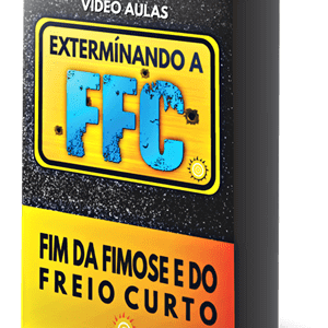 Onde achar o Extermínando a FFC para comprar com segurança