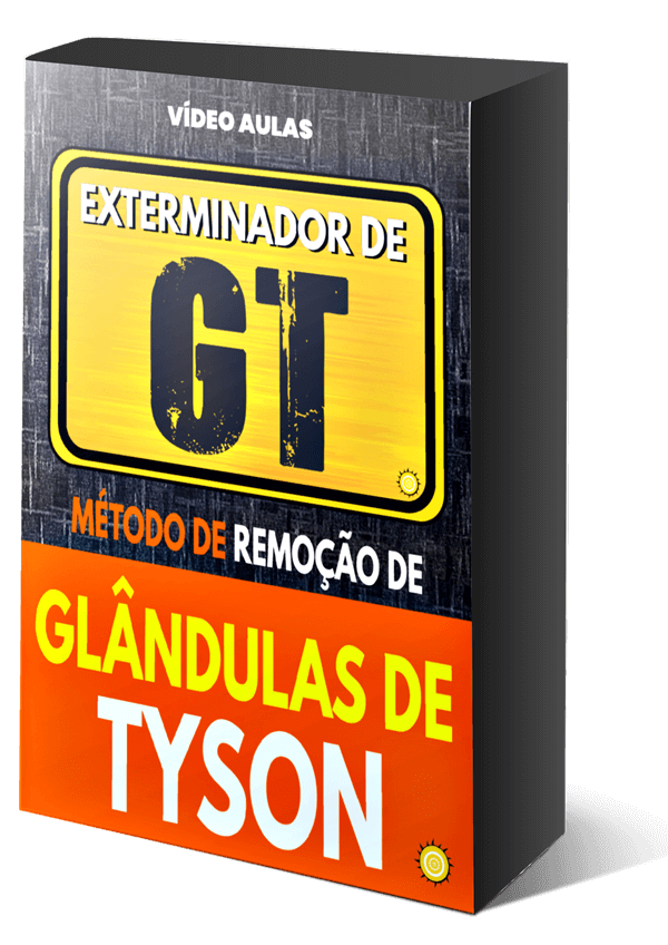 mockup exterminador de gt redimensionado 1 - Exterminador De GT - Método De Remoção De Glândulas De Tyson