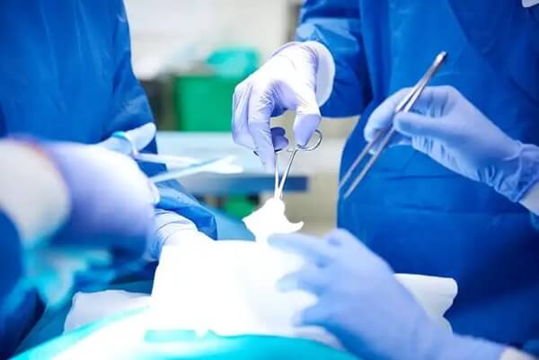 frenuloplastia quanto tempo dura