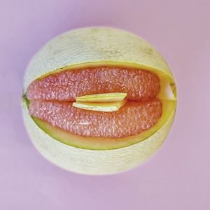 O que é fimose feminina e qual o tratamento?