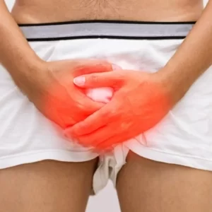 Fimose Inflamada Como Curar Rápido e Evitar a Cirurgia