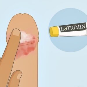 Mau cheiro e inflamação do prepúcio: dicas de higiene para evitar inflamações